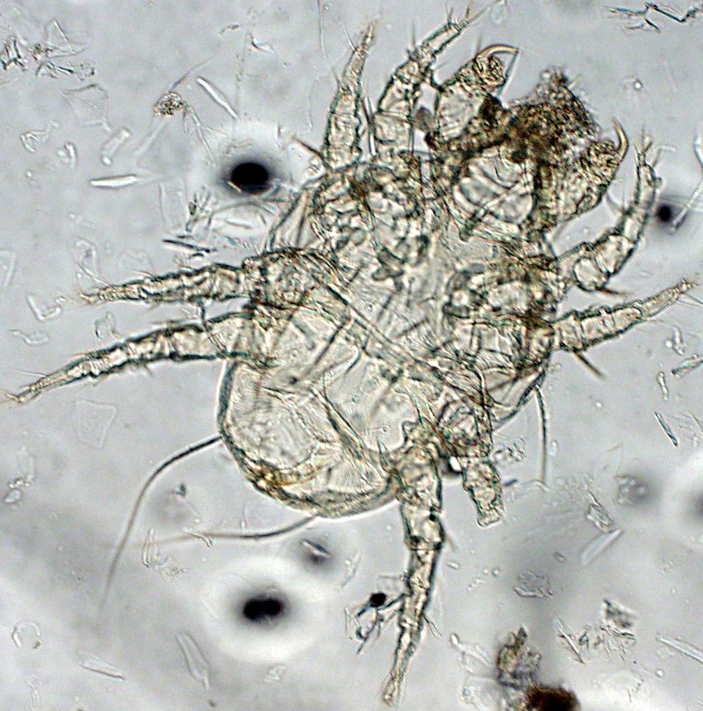 Pest_mgt_Itch mange mite