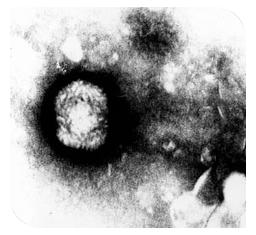 Avipoxvirus